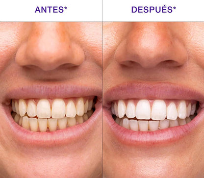 Blanqueador Dental V34 Whitebro – 60ml