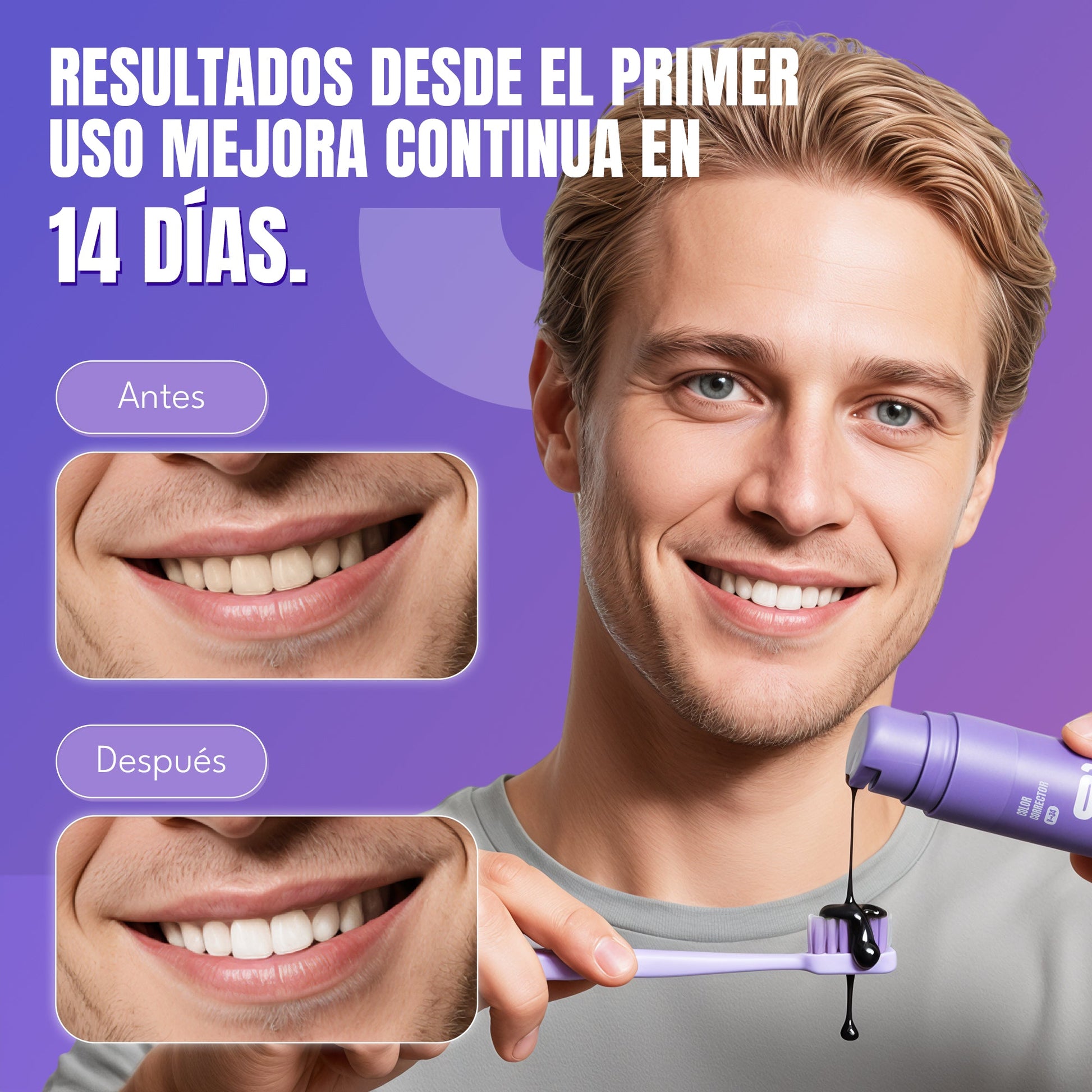 Blanqueador Dental V34 Whitebro – 60ml
