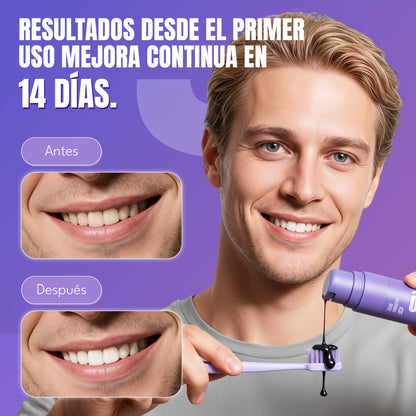Blanqueador Dental V34 Whitebro – 60ml