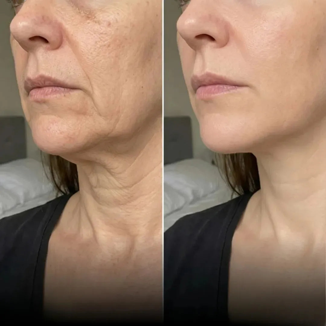 BeeFit Skin™ Crema con Veneno de Abeja Mejora tu Piel y Alivia el dolor en Articulaciones